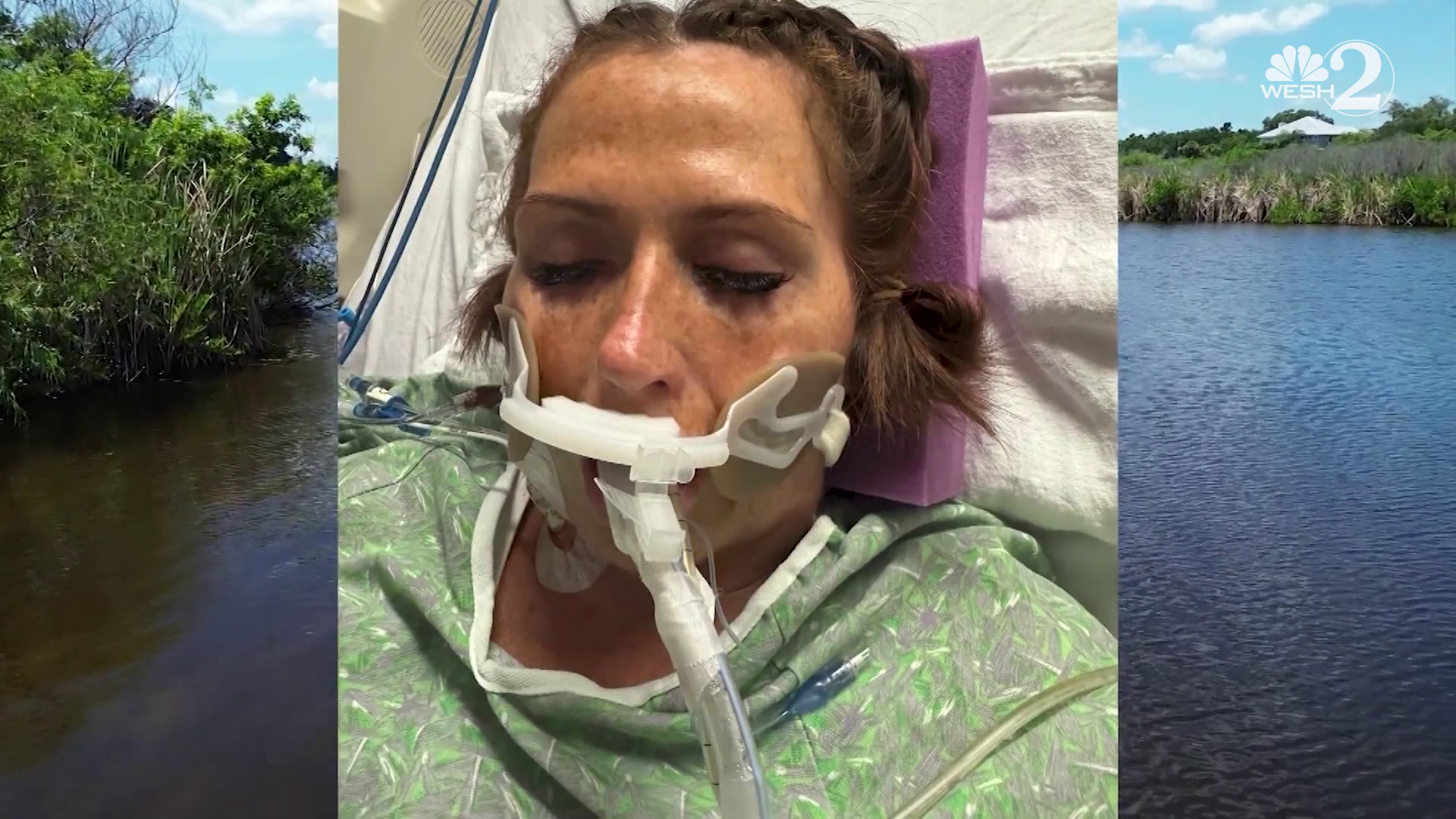 Health experts warn of flesh-eating bacteria in floodwaters — WESH 2 Orlando