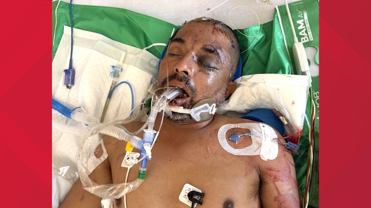 University Hospital asks for help identifying unconscious patient hit by truck Saturday evening — KENS 5 (San Antonio), Shorewood Health news