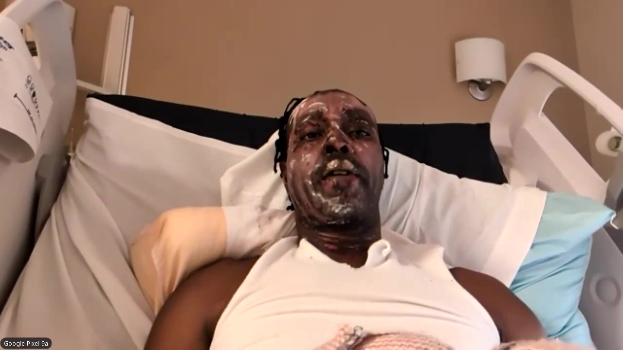 Food truck owner John Martinez recovering after a serious explosion incident.