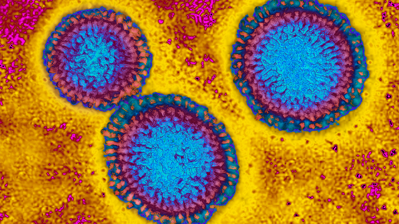 Flu hospitalizations 'slightly higher' than usual, officials urge vaccinations — FOX 9, Shorewood Health news